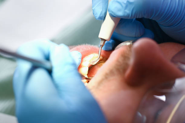 Best Emergency Treatment for Oral Infections in Wading River, NY